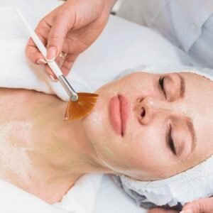Chemical peel